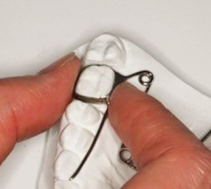 Loose Bracket