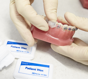 Orthodontic Pain or Discomfort